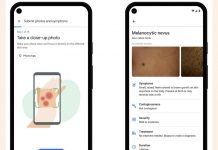GOOGLE MUND T’I NDIHMOJË NJERËZIT TË IDENTIFIKOJNË PROBLEMET NË LËKURË