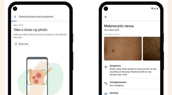 GOOGLE MUND T’I NDIHMOJË NJERËZIT TË IDENTIFIKOJNË PROBLEMET NË LËKURË