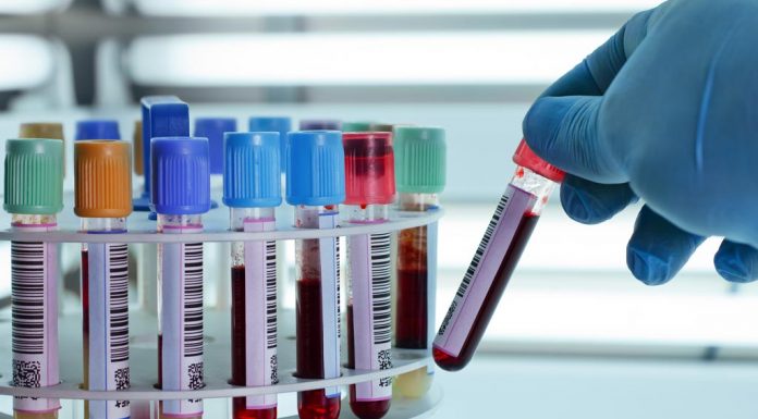 Fillon realizimi i analizave biokimike ne QMF ne Gjonaj