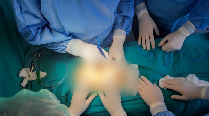 NË QKUK KRYHET NJË INTERVENIM I RRALLË