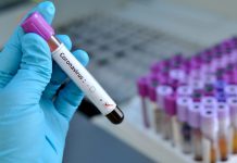 KRYETARËT E KOMUNAVE PAJTOHEN ME MASAT E REJA ANTI-COVID