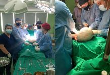 Realizohet intervenim i vështirë kirurgjik në Spitalin e Mitrovicës, pacientit i hiqet një pjesë tumori prej 8 kilogramësh