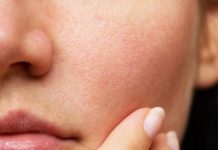 Një mënyrë e shpejt për të zvogëluar poret