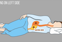 Fjetja në anën e majtë dhe ndikimi në shëndet