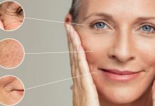 5 këshilla për parandalimin e rrudhave