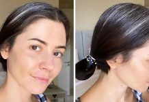 Pse shfaqen thinjat në moshë të re?