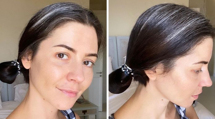 Pse shfaqen thinjat në moshë të re?