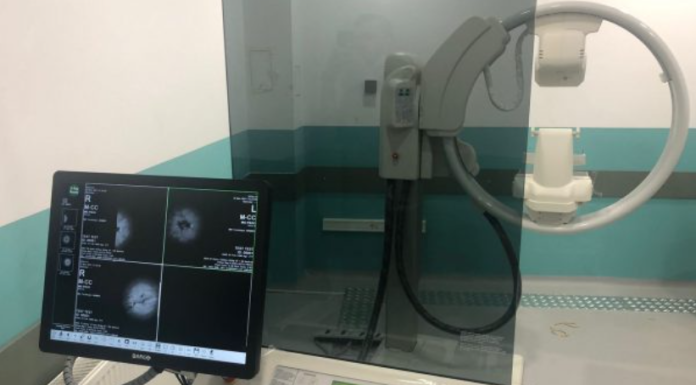 Spitali i Ferizajt bëhet për herë të parë me Mamograf